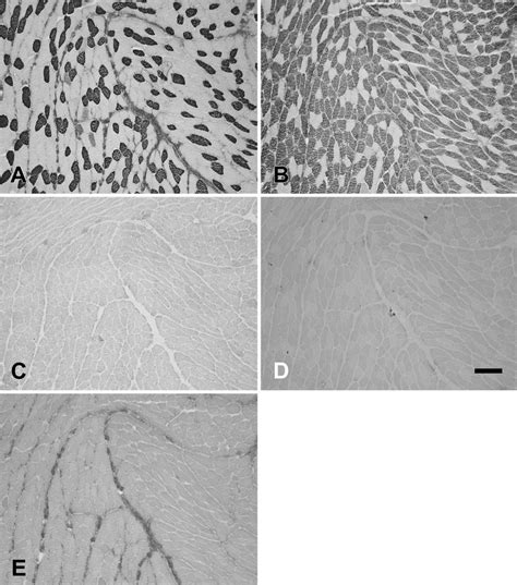 Photomicrographs Of Immunoperoxidase Stained Semiserial Sections Of The