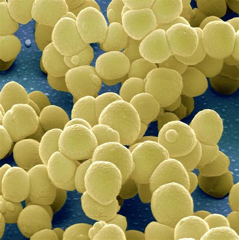 Staphylococcus Aureus Bacteria Photograph By Juergen Berger Science