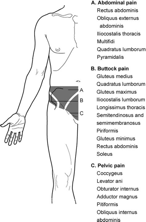 Figure 2 From Chronic Pelvic Pain Pelvic Floor Problems Sacro Iliac