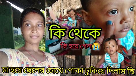 মা হয়ে ছেলের চোখে পোকা ঢুকিয়ে দিলাম ছিঃ।। সত্যিই আমি অপরাধী😭 Viral