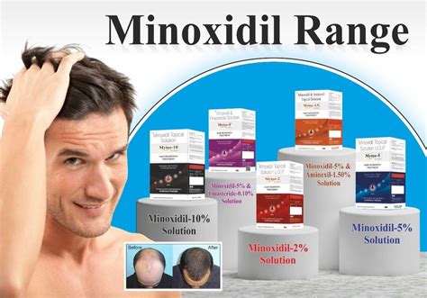 Minoxidil 5 Hair Regrowth Solution Packaging Size 60 Ml At Rs 4801