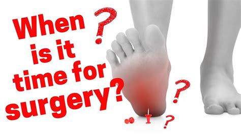 When Do You Need Surgery For Heel Pain Youtube