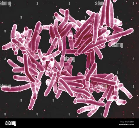 Micrografía electrónica de Mycobacterium tuberculosis la bacteria que