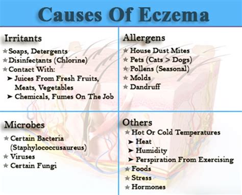 All About Symptoms And Causes Of Eczema Eczema Eczema Causes What