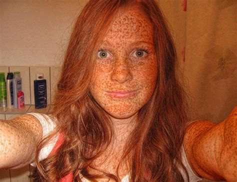 More Freckly Redheads Though I Think She Has More Freckled Area Than