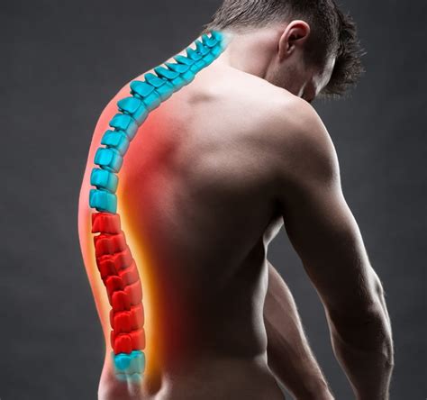 Kyphosis Vs Lordosis What Are The Differences Nj Spine And Orthopedic