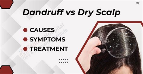Dandruff Vs Dry Scalp Causes Symptoms And Treatment