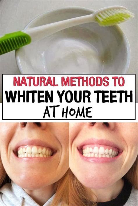 Pin On Natural Teeth Whitening Remedies