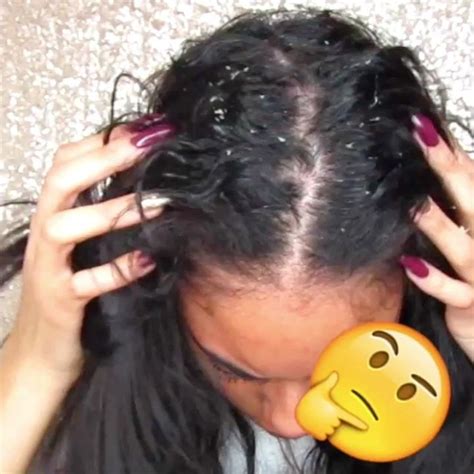 Highlights are a no no for thin, brittle hair and i would have to use harsh color to even go a little bit lighter. Say Yes to Healthy Hair: How to Stop Thinning Edges, Dry ...