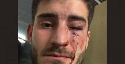 Por qué afganistán es hoy más peligroso que nunca. Noticias de hoy: Detenidas dos personas por una agresión ...