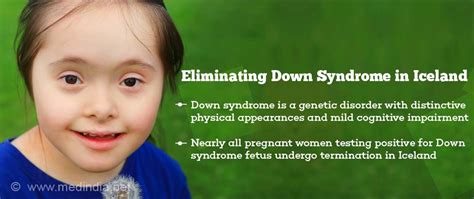 Disappearing Rates Of Down Syndrome In Iceland