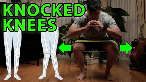 3 Power Exercises For Knocked Knees Genu Valgus Flat Feet Youtube