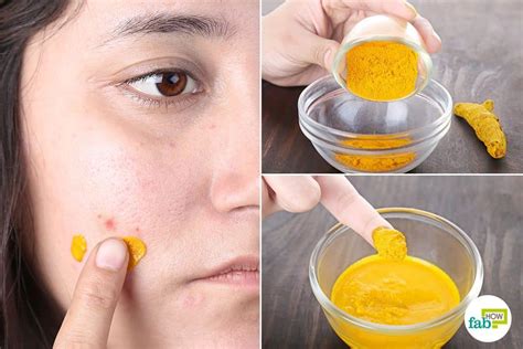 How To Use Turmeric For Dark Spots Methods That Work Fab How