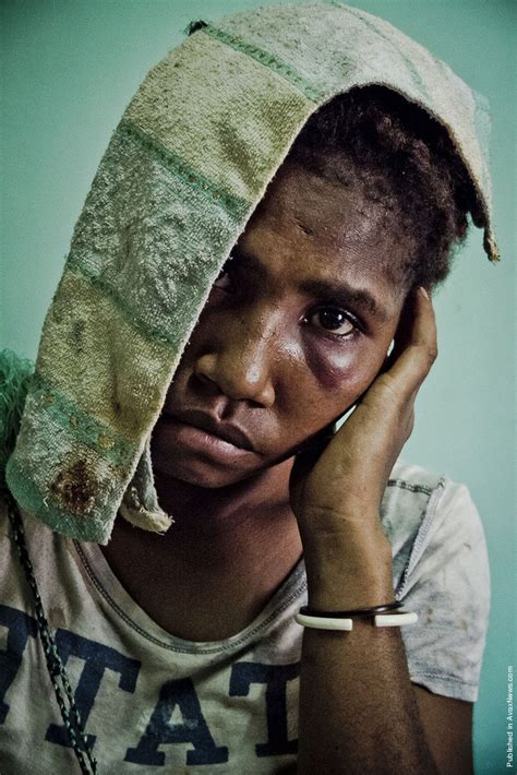 photographers vlad sokhin “violence against women in papua new guinea”