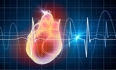 Electrocardiograma Ecg Cardiavant