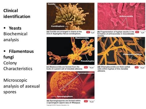 9 bio265 viruses fungi protozoa helminths instructor dr di bonaven…