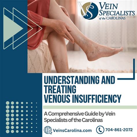 Understanding And Treating Venous Insufficiency A Comprehensive Guide