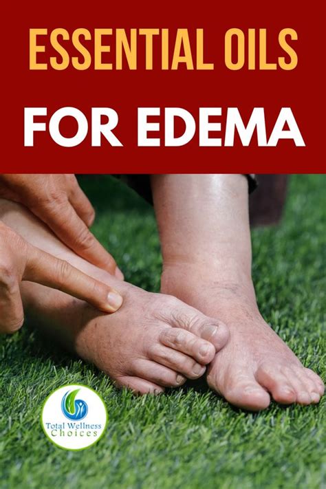 Top 5 Essential Oils For Swollen Feet And Ankles Foot Remedies