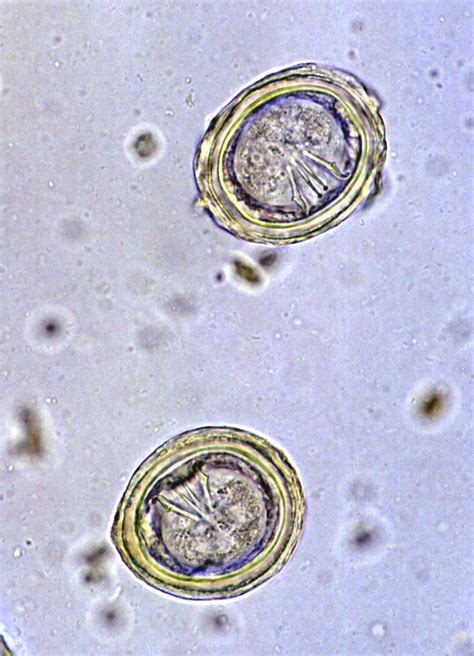 Flea larvae eat tapeworm eggs. Animal Parasitology