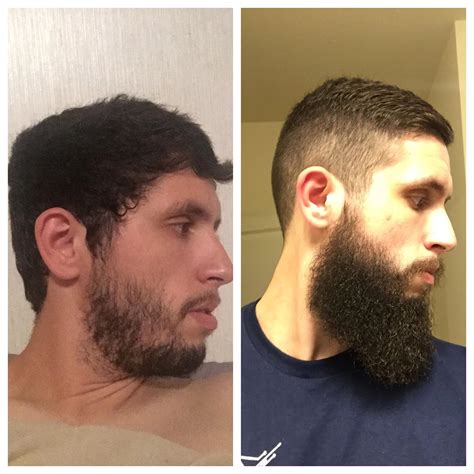 How can one grow a beard? A little late, but here's my yeard with a before and after ...