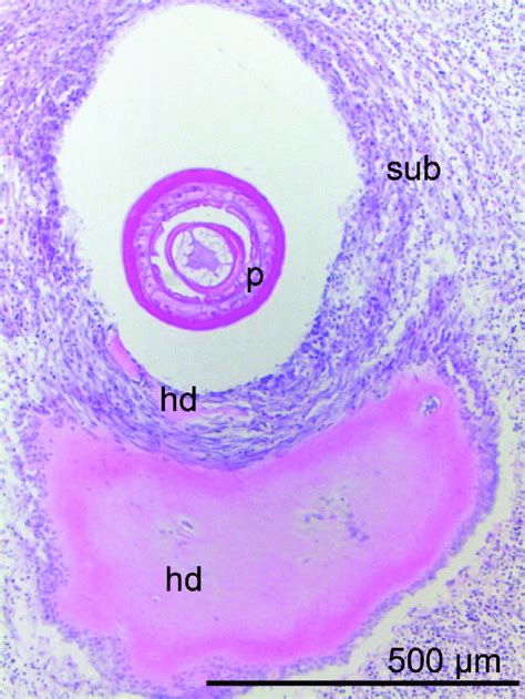 The Border Of The Submucosa And Muscularis Of Intestine In Which