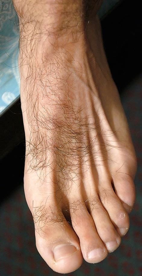 Hairy Feet And Sexy Men 30 Pics Xhamster