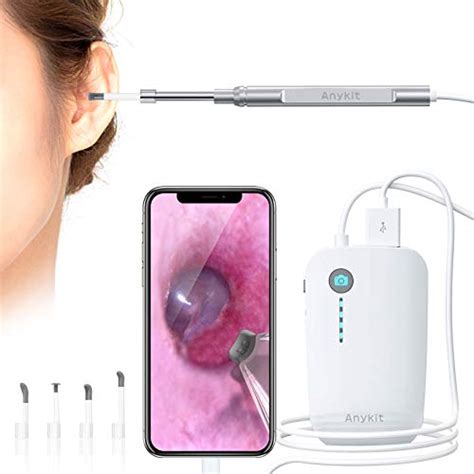 Best Digital Otoscope For Iphone Reviews And Buying Guides The Sweet