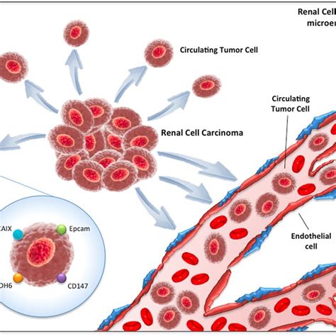 Circulating Tumor Cells Ctcs In Renal Cell Carcinoma Download
