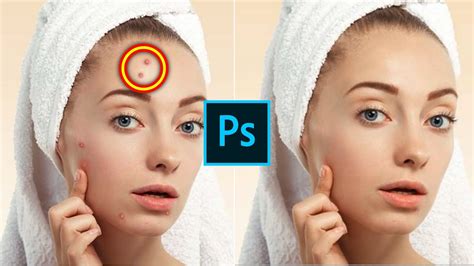How To Remove Pimples From A Photo Photoshop Tutorial YouTube