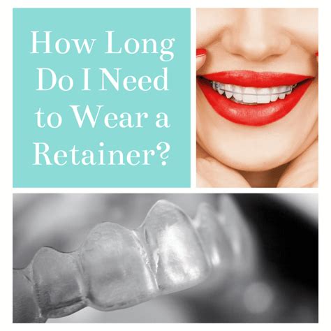 How Long Do I Need To Wear A Retainer