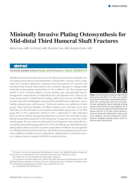 Pdf Minimally Invasive Plating Osteosynthesis For Mid Distal M3