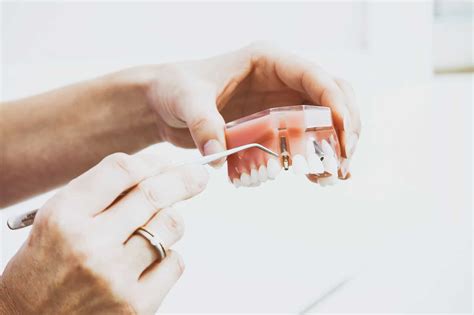 5 Signs Of Dental Implant Failure