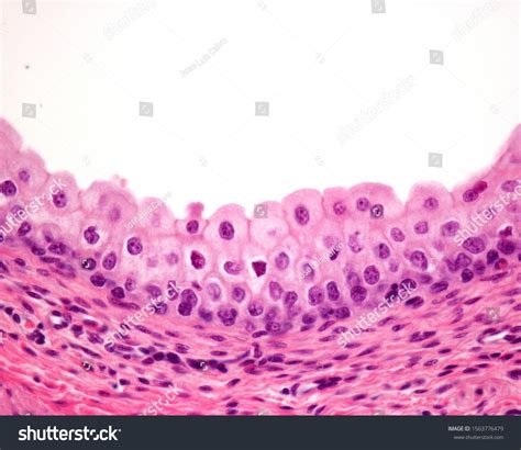 Mucosa Urinary Bladder Lined By Transitional Stock Photo 1563776479