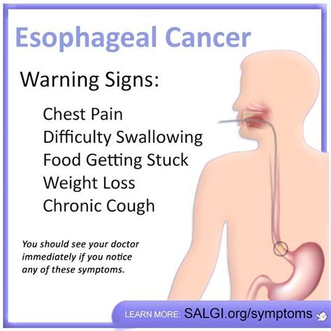 Images About Esophageal Cancer Awareness On Pinterest Chronic Hot Sex Picture