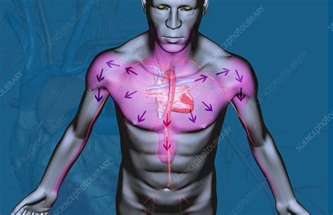 Chest Pain Stock Image C0081977 Science Photo Library