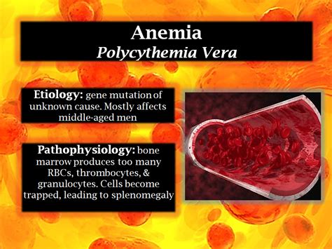 Polycythemia Vera Is A Myeloproliferative Disorder Anemia Nursing My