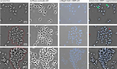 A Reconstructed Phase Image Of A Fixed Cell Culture Of HeLa Cells For Download Scientific