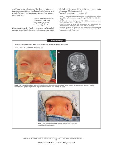 Bilateral Microphthalmia With Orbital Cysts In Wolf Hirschhorn Syndrome