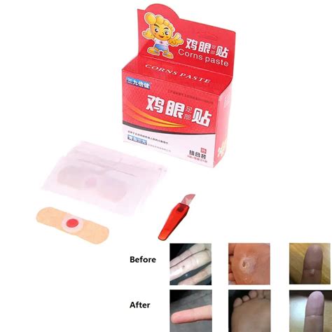 7pcs Detox Foot Pads Patches Feet Care Medical Plaster Foot Corn Removal Remover Callus Corn