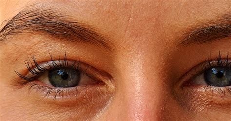 Remove Lines Under Eyes Effective Tips To Get Rid Of Wrinkles Under Eye