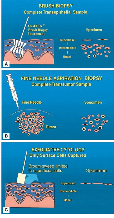 Figure 3 From Improving Detection Of Precancerous And Cancerous Oral