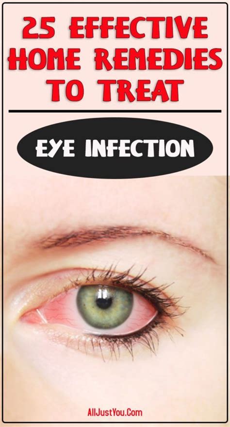 25 Effective Home Remedies To Treat Eye Infection With Images Eye
