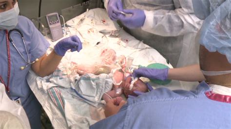 Special Nicu Mimics Mothers Womb For Micro Preemies Cnn