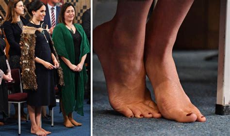 Meghan Markle Feet Why Does Meghan Markle Have A Scar On Her Feet Is