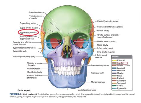 Solved The Zygomatic Process Is A Narrow Projection Of The Course Hero