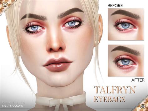 Pin By Taylor On The Sims 4 Cc Eye Bags Eye Bags Treatment Sims