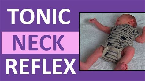 Tonic Neck Reflex In Infant Newborn Pediatric Nursing Newborn