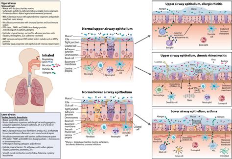 Frontiers Airway Epithelial Dynamics In Allergy And Related Chronic