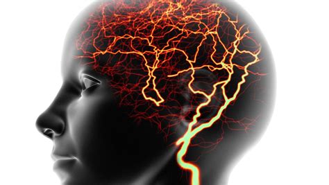Epilepsie Wie Die Krankheit Entsteht Wie Sie Sich Behandeln Lässt