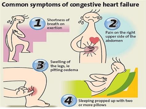 Increased plethora of organ or tissue due to reduced • heart failure is a pathological condition caused by the inability of heart to provide adequate blood. Heart failure-treatment-options-india